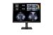 Monitor LG 31HN713D-B.AWM de Diagnóstico para Mamografía IPS 12MP de 31 pulgadas - 