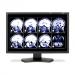 NEC MD242C2 24" Black pantalla plana para PC