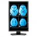 NEC MD242C2 24" Black pantalla plana para PC