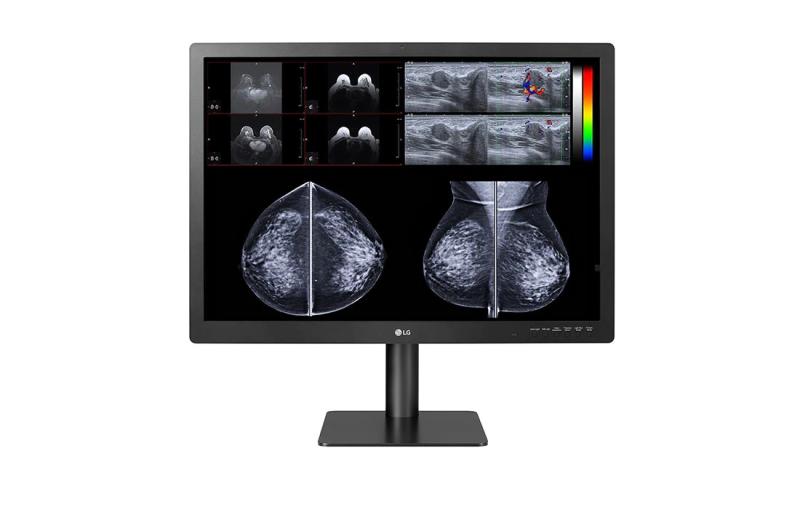 Monitor LG 31HN713D-B.AWM de Diagnóstico para Mamografía IPS 12MP de 31 pulgadas - 